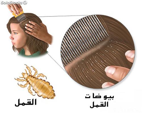 المشط الكهربائي لإزالة القمل - V-Comb